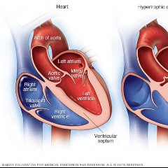 HEART ID 19