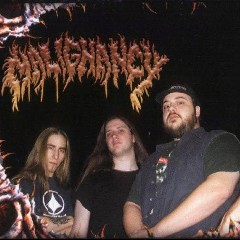 Malignancy