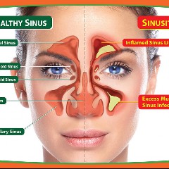 Sinus