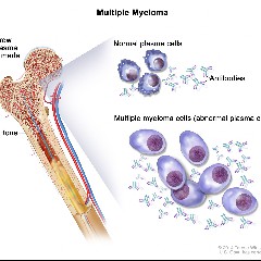 MayloMa
