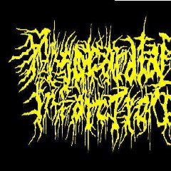 Myocardial Infarction
